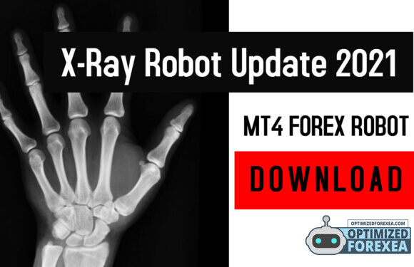 X-Ray robotopdatering 2021 – Onbeperkte weergawe aflaai